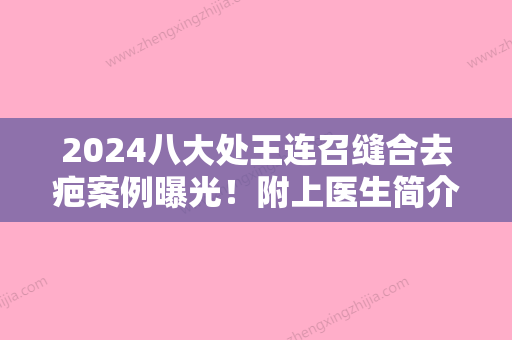 2024八大处王连召缝合去疤案例曝光！附上医生简介+价格一览2024