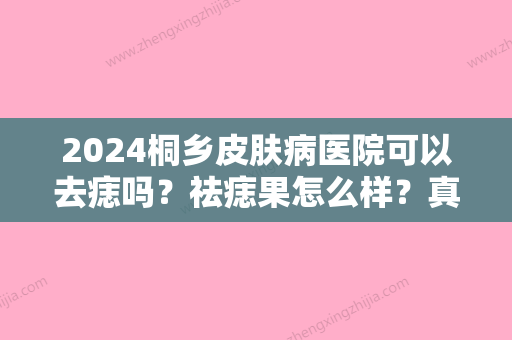 2024桐乡皮肤病医院可以去痣吗？祛痣果怎么样？真人祛痣前后果来袭