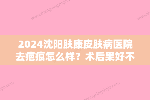 2024沈阳肤康皮肤病医院去疤痕怎么样？术后果好不好？内附真实祛疤果