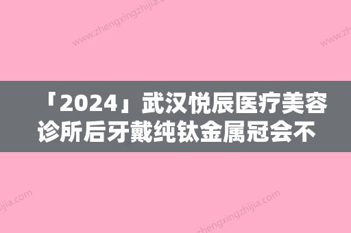 「2024」武汉悦辰医疗美容诊所后牙戴纯钛金属冠会不会伤害到皮肤