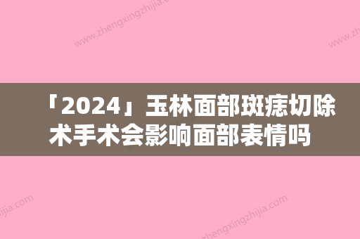 「2024」玉林面部斑痣切除术手术会影响面部表情吗