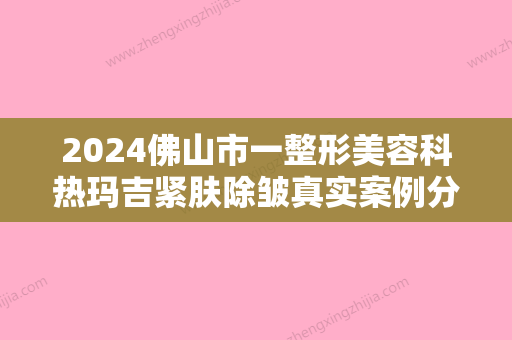 2024佛山市一整形美容科热玛吉紧肤除皱真实案例分享	，整形医生介绍