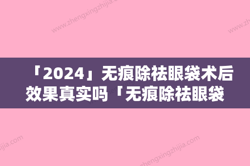 「2024」无痕除祛眼袋术后效果真实吗「无痕除祛眼袋整形多久后效果比较好」