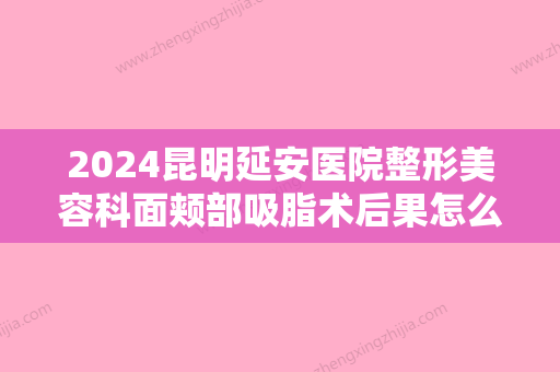 2024昆明延安医院整形美容科面颊部吸脂术后果怎么样？附面部吸脂案例