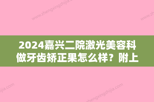 2024嘉兴二院激光美容科做牙齿矫正果怎么样？附上医院医生实操案例分享！