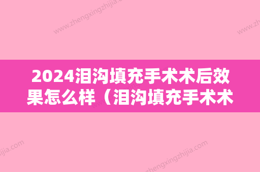 2024泪沟填充手术术后效果怎么样（泪沟填充手术术后效果怎么样图片）