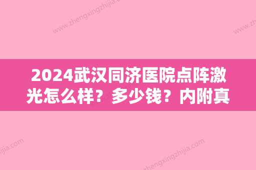 2024武汉同济医院点阵激光怎么样？多少钱？内附真人祛疤案例分享~