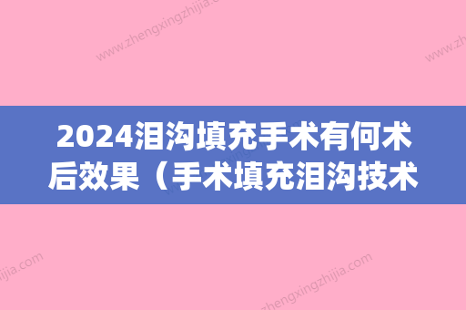 2024泪沟填充手术有何术后效果（手术填充泪沟技术成熟吗?）(泪沟填充术复杂吗?手术时间要多久)