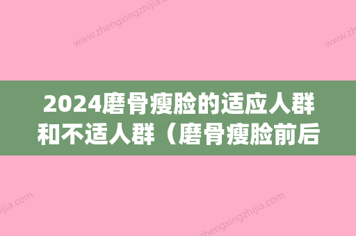 2024磨骨瘦脸的适应人群和不适人群（磨骨瘦脸前后对比）(磨骨真的可以瘦脸吗)