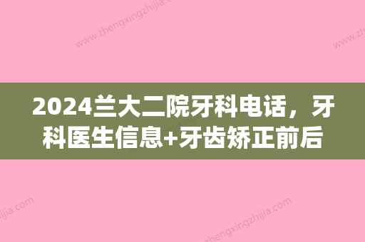 2024兰大二院牙科电话，牙科医生信息+牙齿矫正前后果对比(兰大二院口腔科)