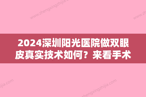 2024深圳阳光医院做双眼皮真实技术如何？来看手术后的果就知道了