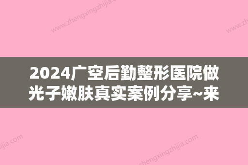 2024广空后勤整形医院做光子嫩肤真实案例分享~来看详细介绍吧