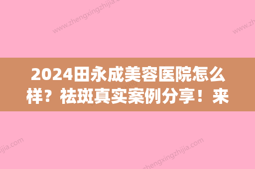 2024田永成美容医院怎么样？祛斑真实案例分享！来看果好不好~(田永成整形 美容医院)