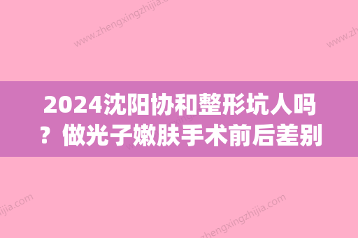 2024沈阳协和整形坑人吗？做光子嫩肤手术前后差别大吗？(沈阳202医院整形)