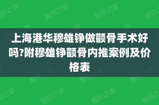 上海港华穆雄铮做颧骨手术好吗?附穆雄铮颧骨内推案例及价格表