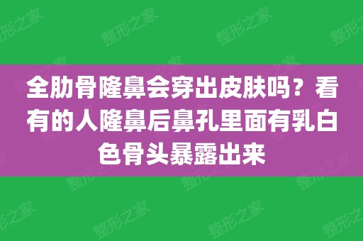 隆鼻后鼻孔内白色骨头图片