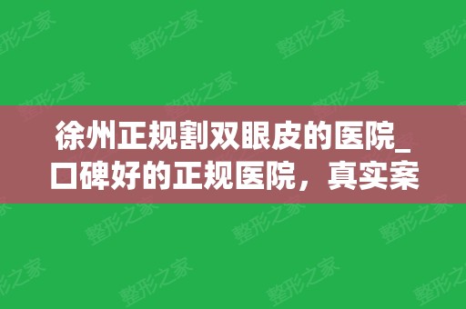 徐州正规割双眼皮的医院_口碑好的正规医院，真实案例公布