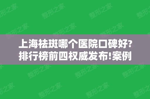 上海祛斑哪个医院口碑好?排行榜前四权威发布!案例及价格费用供参考