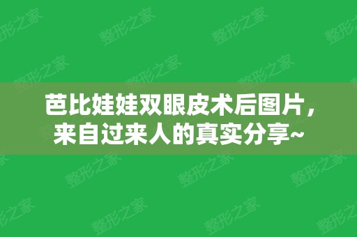 芭比娃娃双眼皮术后图片，来自过来人的真实分享~