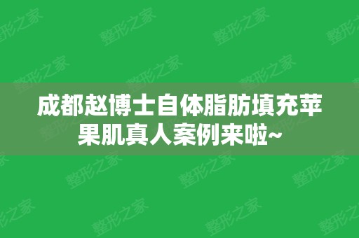 成都赵博士自体脂肪填充苹果肌真人案例来啦~