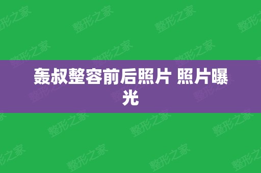 轰叔整容前后照片 照片曝光