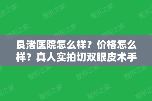 良渚医院怎么样？价格怎么样？真人实拍切双眼皮术手术