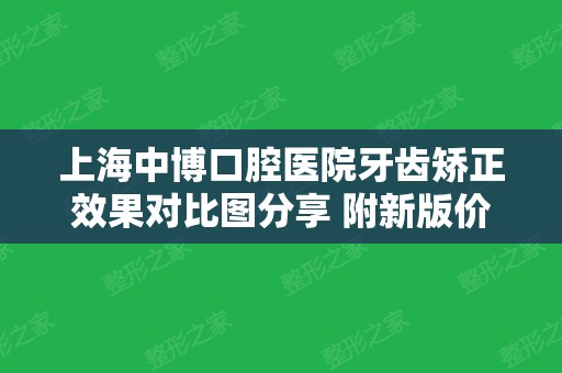 上海中博口腔医院牙齿矫正效果对比图分享 附新版价格表参考