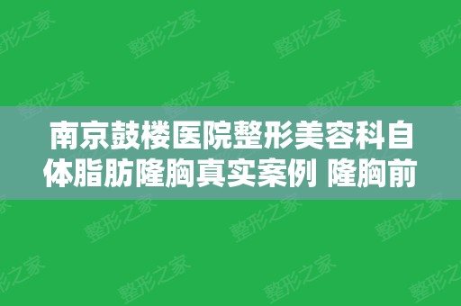 南京鼓楼医院整形美容科自体脂肪隆胸真实案例 隆胸前后对比图分享