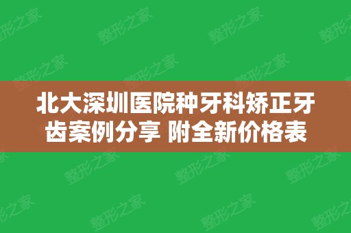 北大深圳医院种牙科矫正牙齿案例分享 附全新价格表一览