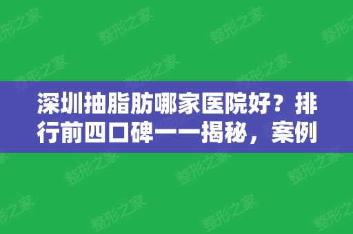 深圳抽脂肪哪家医院好？排行前四口碑一一揭秘，案例及价格价位表这也有